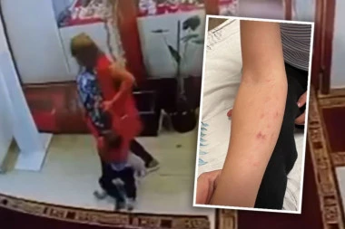 UŽAS U KOSOVU POLJU! Vaspitačice maltretirale i zlostavljale TROGODIŠNJEG dečaka, snimak sve dokazuje, dete u KRVAVIM PODLIVIMA! (FOTO)