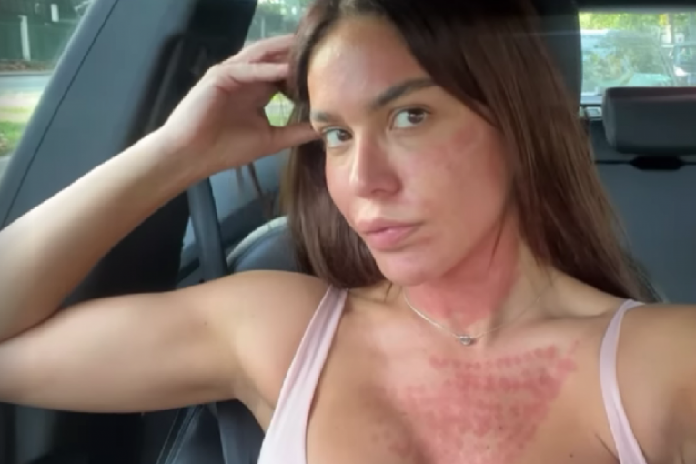 Marina Visković izgorela