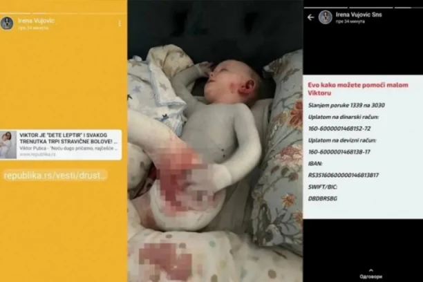 SAD SVI SLOŽNO ZA BEBU VIKTORA: I ministarka Vujović se uključila u humanitarnu akciju!