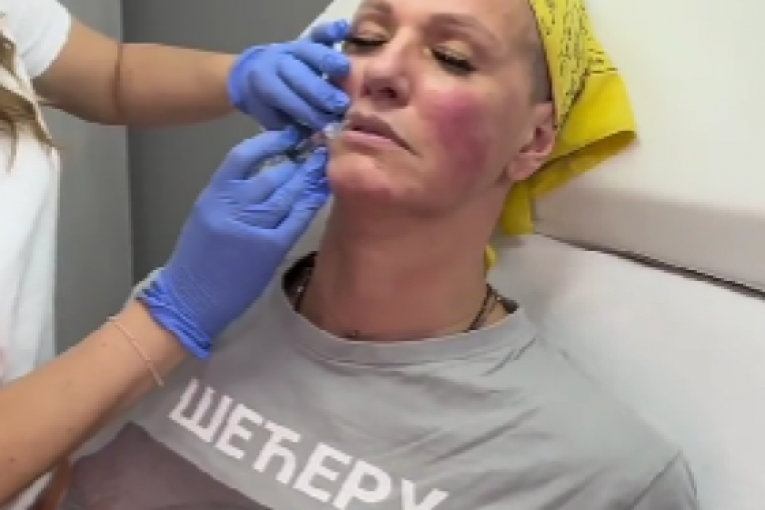 Tijana Dapčević radi usne