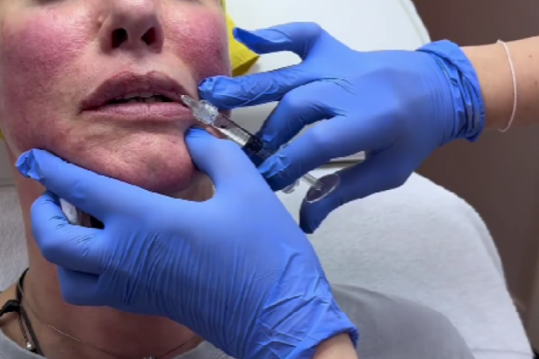 Tijana Dapčević radi usne