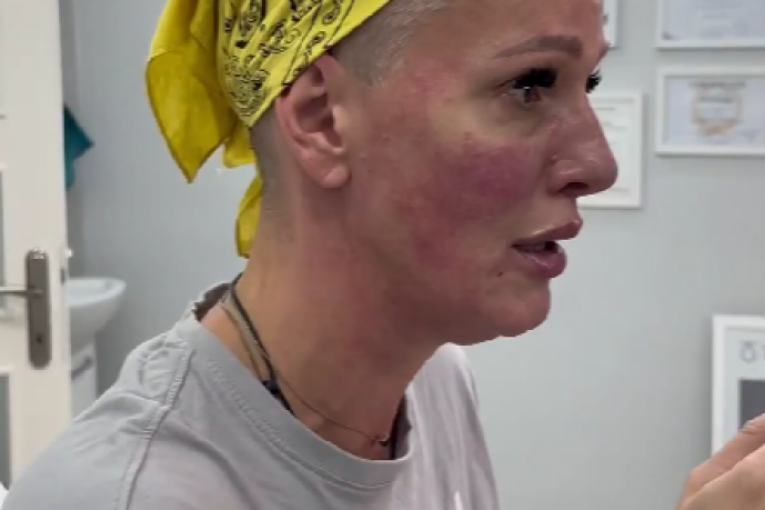 Tijana Dapčević radi usne