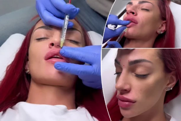 BIVŠA ZADRUGARKA POKAZALA "NOVO LICE!" Tara Simov otišla na remont, fanovi je ne prepoznaju! (FOTO)