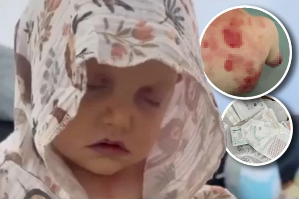 MALI VIKTOR GOTOVO DA NE PLAČE, ALI MU SE NA SVAKOJ CRTI LICA VIDI BOL! Satima mu čiste RANE, ali dečak ne prestaje da se bori - potrebna mu je i naša pomoć! (VIDEO)