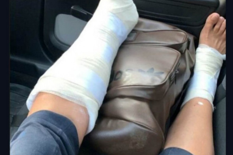 Aleksandra Janković noga u gipsu instagram