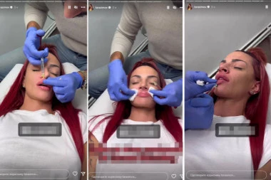 NOVI DAN, NOVA INTERVENCIJA! Tara Simov promenila lični opis, fanovi se pitaju šta je sledeće! (FOTO)