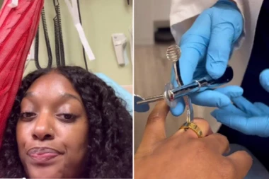 OBILAZILA JE BOLNICE 14 SATI TRAŽEĆI POMOĆ: Lekari su bezuspešno pokušavali da reše problem, prst joj je pomodreo i oticao sve više! (VIDEO)