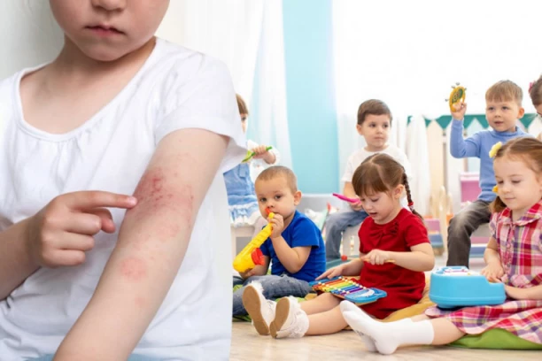 SVAKOG DANA NAJMANJE JEDNO DETE DOĐE SA KOKSAKI VIRUSOM! Opet pune ambulante, a OVO je način da prepoznate zarazu!