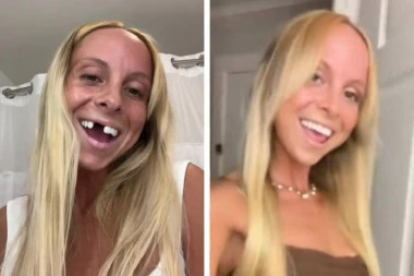 TIKTOKERKA DOŽIVELA NESREĆU, OSTALA BEZ ZUBA: Jeziva sudbina lepe influenserke LEDI KRV U ŽILAMA!