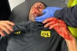 UŽAS NA VELODROMU: Huliganski pir - navijači Olimpika iz Marseja razbili glavu treneru Liona!