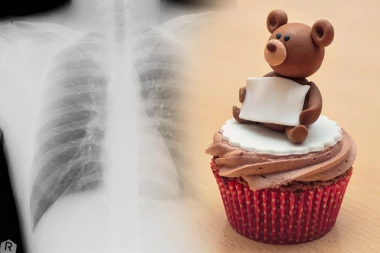 DECA SU DOBRO, ŽICA JE IZAŠLA! Epilog drame nakon dečijeg rođendana: Trogodišnjaci pojeli mafine sa metalnim predmetima!