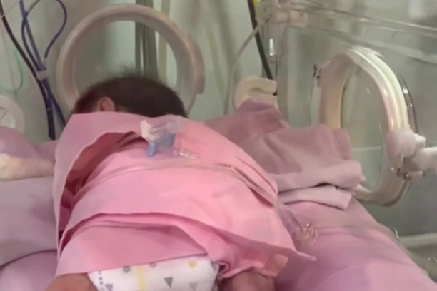 TEK ROĐENA BEBA ZAPREPASTILA LEKARE: Zbog onoga što je radila u INKUBATORU sedam miliona ljudi drži se za glavu (FOTO/VIDEO)