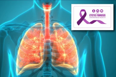 OD CISTIČNE FIBROZE NAJČEŠĆE OBOLJEVAJU DECA: Ovo su simptomi, najvažnije započeti terapiju na vreme!