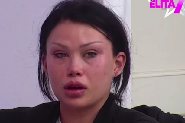 TEODORA BALZAK U JEZIVIM MODRICAMA: Uznemiravajuća slika napravila HAOS, šta se dešava sa Bukilićem? (FOTO)