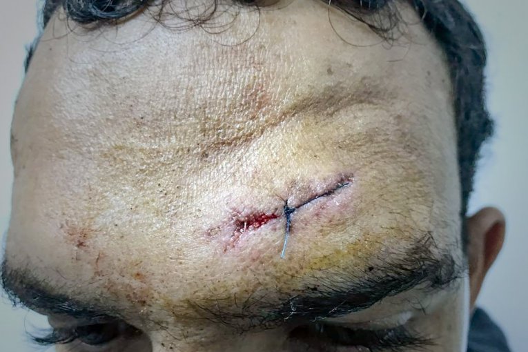 Hrvati  maltretiraku izbeglice