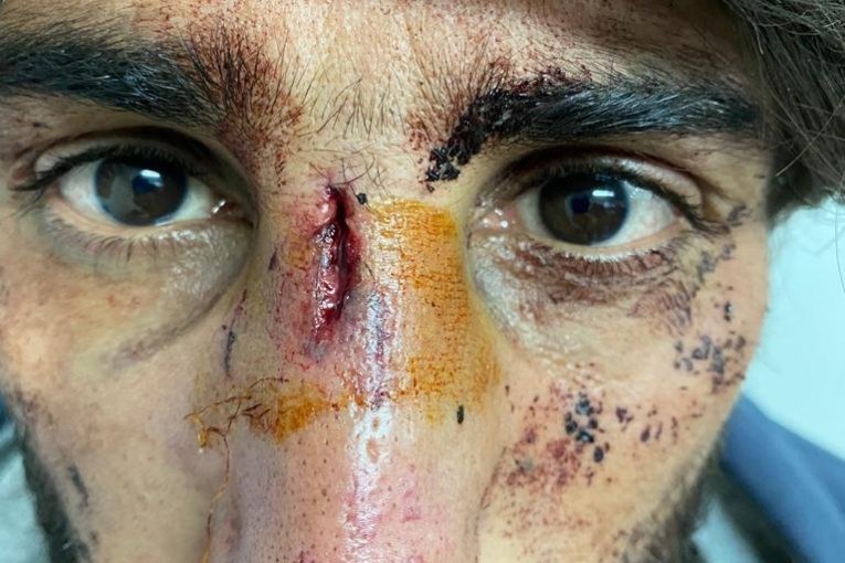 Hrvati  maltretiraku izbeglice