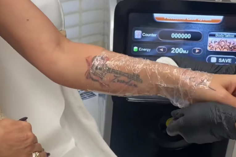 Ana Ćurčić skida tetovažu Zvezdanovo ime