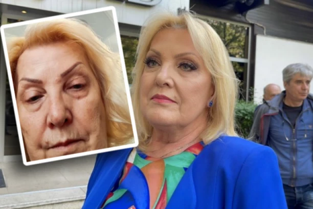 PRAVO LICE SNEŽANE ĐURIŠIĆ: Pevačica BEZ ŠMINKE, filteri zakazali, OVAKVU je nikada niste videli, svi se pitaju da li je MOGUĆE da ovako izgleda!