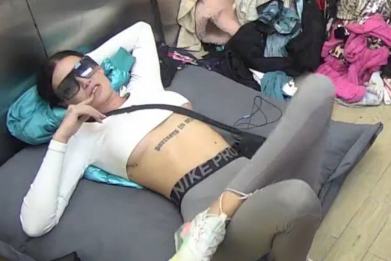 Teodora Balzak pokazala ožiljke od silikona