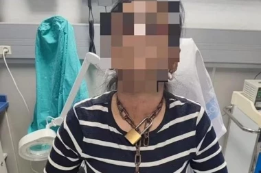 POJAVILA SE U BOLNICI VEZANA LANCIMA: Žena preživela pravu torturu, jedva pobegla od otmičara!