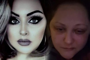 NE HODA, NE PRIČA, NE SPAVA I TRPI NESNOSNE BOLOVE! Mlada majka zbog produženog kovida već dve godine živi u teškom paklu! SKUPLJA NOVAC ZA EUTANAZIJU, NE MOŽE VIŠE!