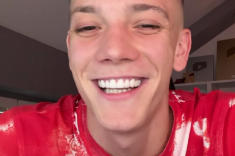 Stefan Janković Janko zubi