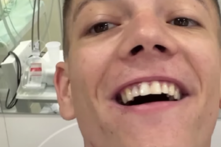 Stefan Janković Janko zubi