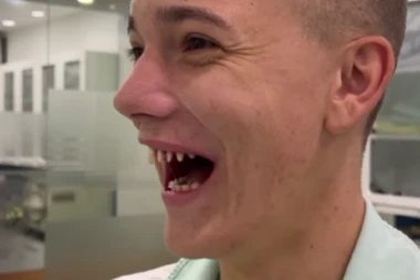 NAŠ TIKTOKER U NOVOM SKANDALU: Isturpijao ZDRAVE ZUBE kako bi stavio veštačke! Da se NAJEŽIŠ od bizarnosti (FOTO)