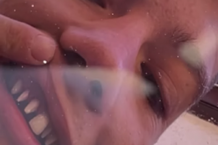 Stefan Janković Janko zubi