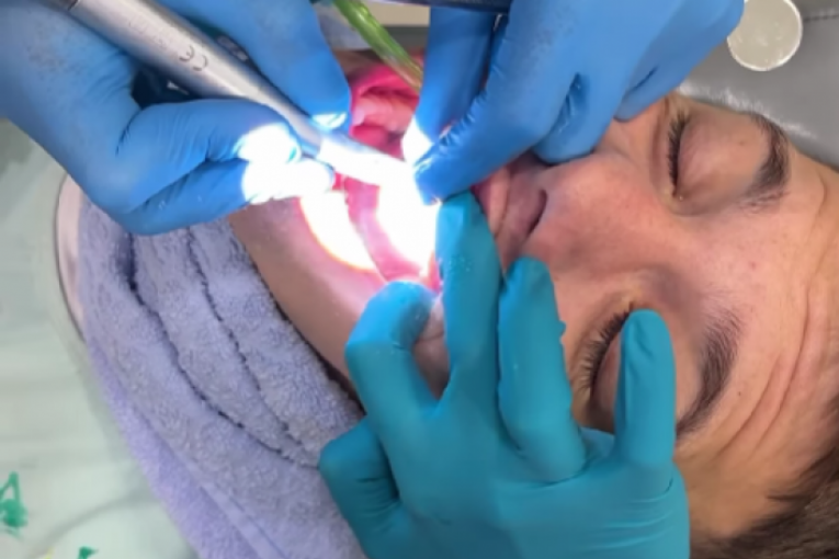 Stefan Janković Janko zubi