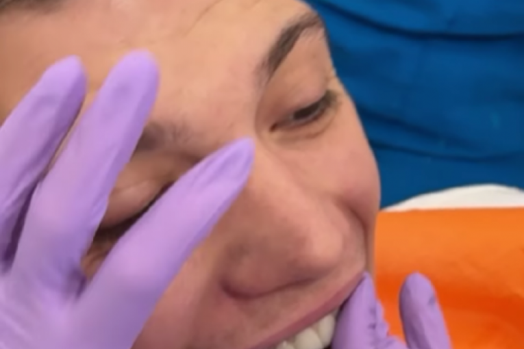 Stefan Janković Janko zubi