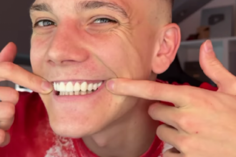 Stefan Janković Janko zubi