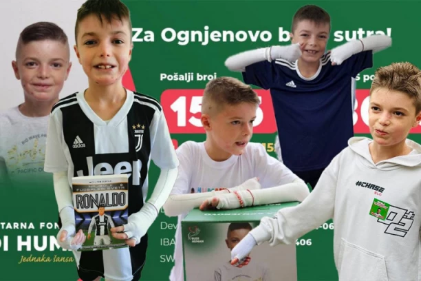 ON ZADNJIM ATOMOM SNAGE STOJI NA NOŽICAMA: Ognjen (10) je dečak leptir, a svojim osmehom POBEĐUJE! ''Kada ga gledam u zavojima, a znam mu svaku ranu, DIVIM mu se!''(FOTO)