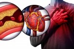 Stručnjaci savetuju kako da smanjite holesterol sprečite bolesti srca i krvnih sudova prirodnim putem