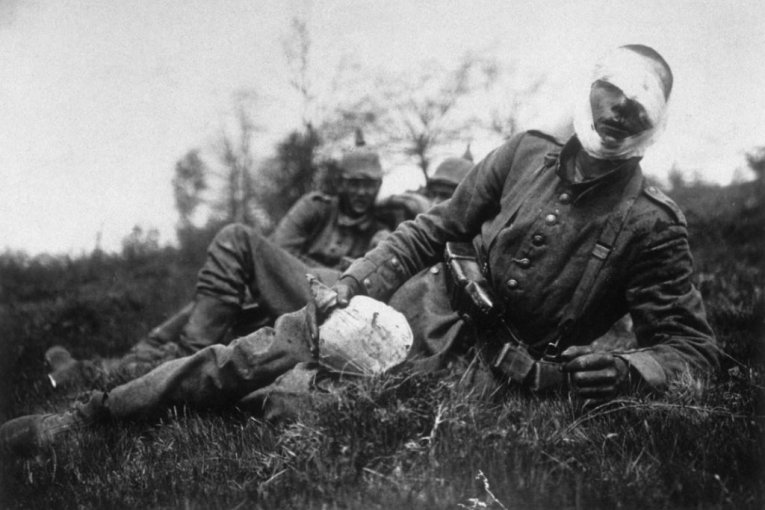 Prvi svetski rat Srbiji je odneo trećinu stanovništva