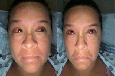 KRV JOJ JE ŠIKLJALA IZ OČIJU ZBOG OVE GREŠKE: "Znala sam da ne treba TO da radim, ali nije bilo izbora!"