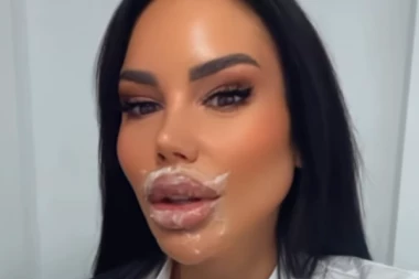 IVA GRGURIĆ VADI SILIKONE: Pobednica "Zadruge" odlučila da vrati PRIRODAN IZLED!