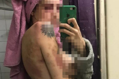 UHAPŠEN NASILNIK KOJI JE PRETUKAO RUSKINJU: Pijan joj iscepao dokumenta, uzeo ušteđevinu, i razbio telefone!