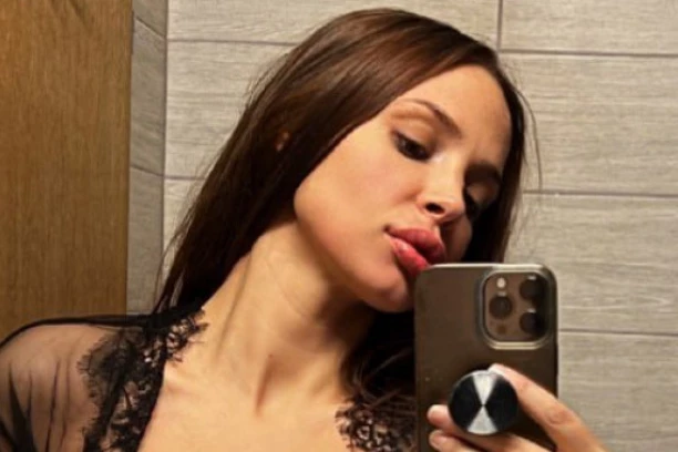 NATAŠA ŠAVIJA OPET PRETUČENA! STARLETA POKAZALA JEZIVE MODRICE! Evo kako je došlo do napada! (FOTO)