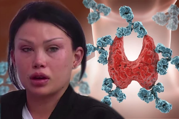 OTKRIVAMO: ZBOG OVE TEŠKE BOLESTI JE TEODORA NAPUSTILA ELITU! Lekarski nalazi lede krv u žilama, život joj VISI O KONCU