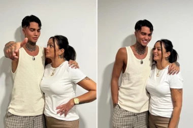 POPULARNI INFLUENSER IMAO PET OPERACIJA U JEDNOM DANU: Kad vidite kako je ranije izgledao, zapitaćete se samo jedno (FOTO)