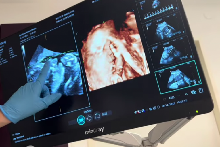 Aleksandra Nikolić pokazuje fotografije sa ultrazvučnog pregleda