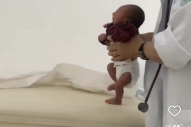 ČAK 18 MILIONA LJUDI U ČUDU POSMATRA ŠTA TEK ROĐENA BEBA RADI: Doktor joj pomaže i ne može da dođe sebi od ŠOKA (FOTO/VIDEO)