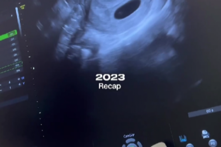 Anastasija Ražnatović Instagram gubitak bebe