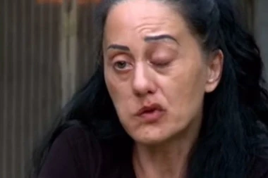 BILJANA JE DOŽIVELA ONO ČEGA SE SVAKI SRBIN PLAŠI: Ustala je ujutru i videla OBEŠENO LICE, a onda su joj lekari saopštili STRAŠNU DIJAGNOZU