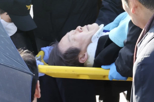 POZNATO STANJE IZBODENOG OPOZICIONOG LIDERA! Napadač mu prišao nakon govora i zario U VRAT oštricu od 18 centimetara! (FOTO)