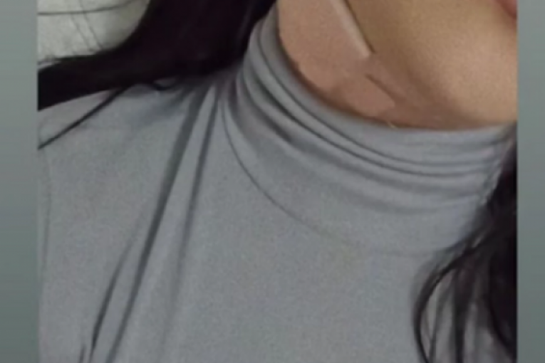 Aleksandra Mladenović zadobila povrede zbog neispravnoh vatrometa