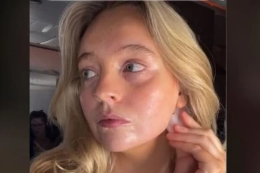 POMOĆU OVE TEHNIKE SE PODMLADILA 10 GODINA: Bez FILERA I BOTOKSA je zaustavila starenje, niko joj ne veruje!