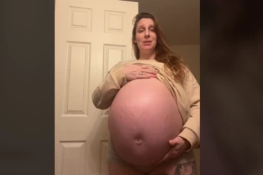 LJUDI TVRDE DA NIKADA NISU VIDELI VEĆI TRUDNIČKI STOMAK: Kada su shvatili koliko joj je još ostalo do POROĐAJA, samo su se držali za glavu (FOTO)