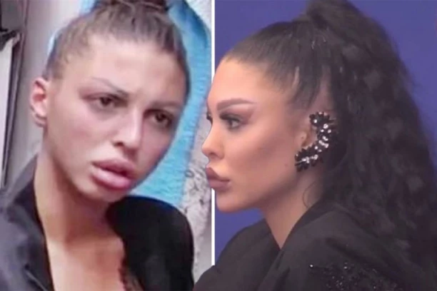 SLIKE KOJE ĆE VAS FRAPIRATI: Ovo je Maja Marinković pre svih OPERACIJA - nećete verovati kako je nekad izgledala!